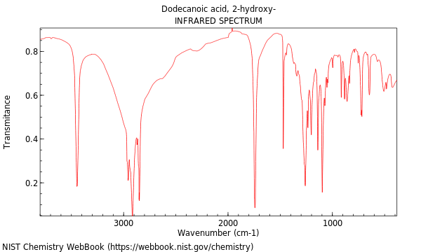 IR spectrum